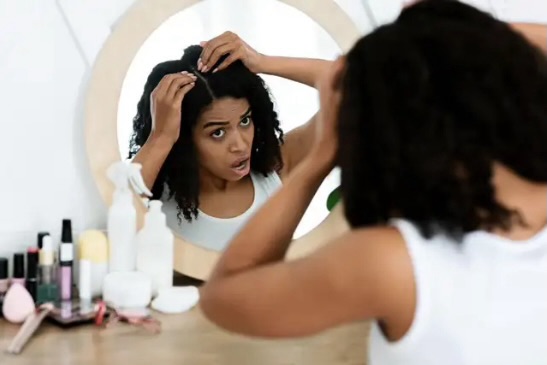 Fight Dandruff the Natural Way: Simple Remedies for a Healthy, Nourished Scalp