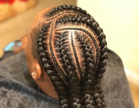 Got A Tense Scalp Trom Tight Braids? Here’s How To Care For It