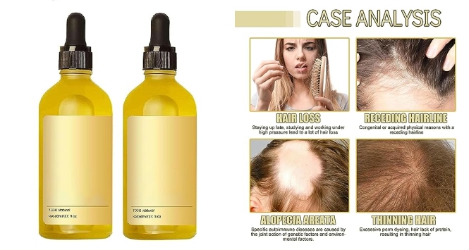 Carvenchi Natural Hair Growth Oil: The Secret to Stronger, Fuller Hair